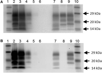 The Scrapie Prevalence in a Goat Herd Is Underestimated by Using a Rapid Diagnostic Test